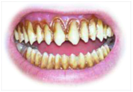 Preview for Yellow-teeth-closeup-mouths-sticker-c79ef