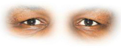 Preview for Close-up-human-eyes-sticker-e6593