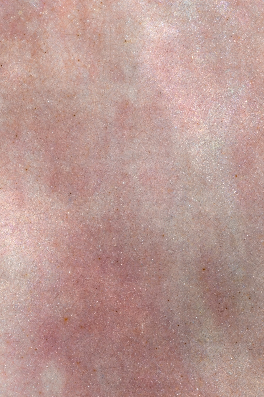Preview for Rose Pearl Crackle Glaze Background