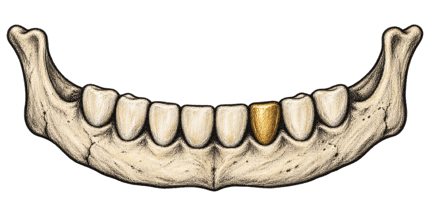 Preview for Detached Ivory Charcoal Skull Jaw With A Gold Tooth