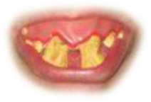 Preview for Yellow-teeth-close-up-mouths-sticker-d8630