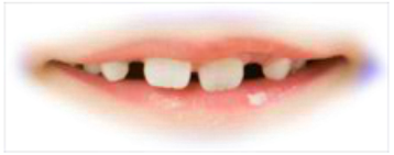 Preview for Healthy-smile-image-mouths-sticker-f958e