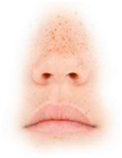 Preview for Glitch-art-face-distortion-mouths-sticker-d5908