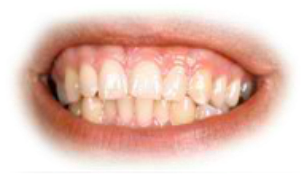 Preview for Healthy-smile-image-mouths-sticker-c1370