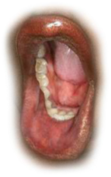 Preview for Oral-health-issue-image-mouths-sticker-9c070