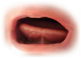 Preview for Vocal-cords-laryngoscopy-view-mouths-sticker-556eb