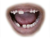 Close-up of an open mouth with white teeth