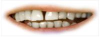 A close-up of a smiling mouth with healthy white teeth