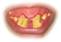 Close-up of yellow teeth