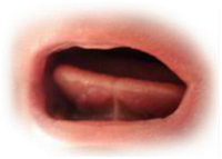 Close-up view of human vocal cords